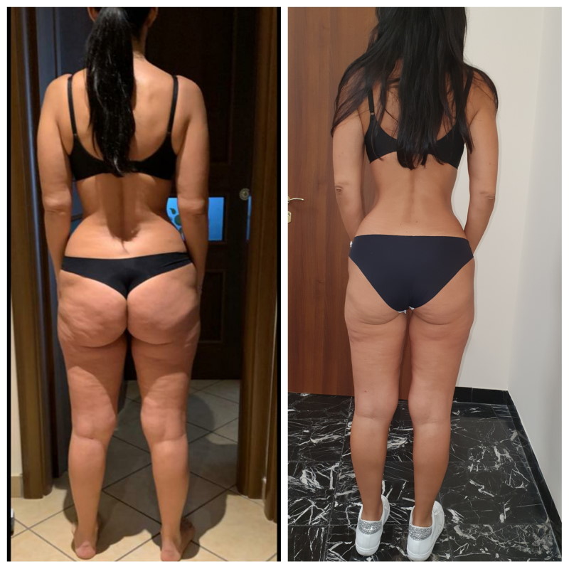 dieta oloproteica risultati napoli dieta oloproteica risultati napoli