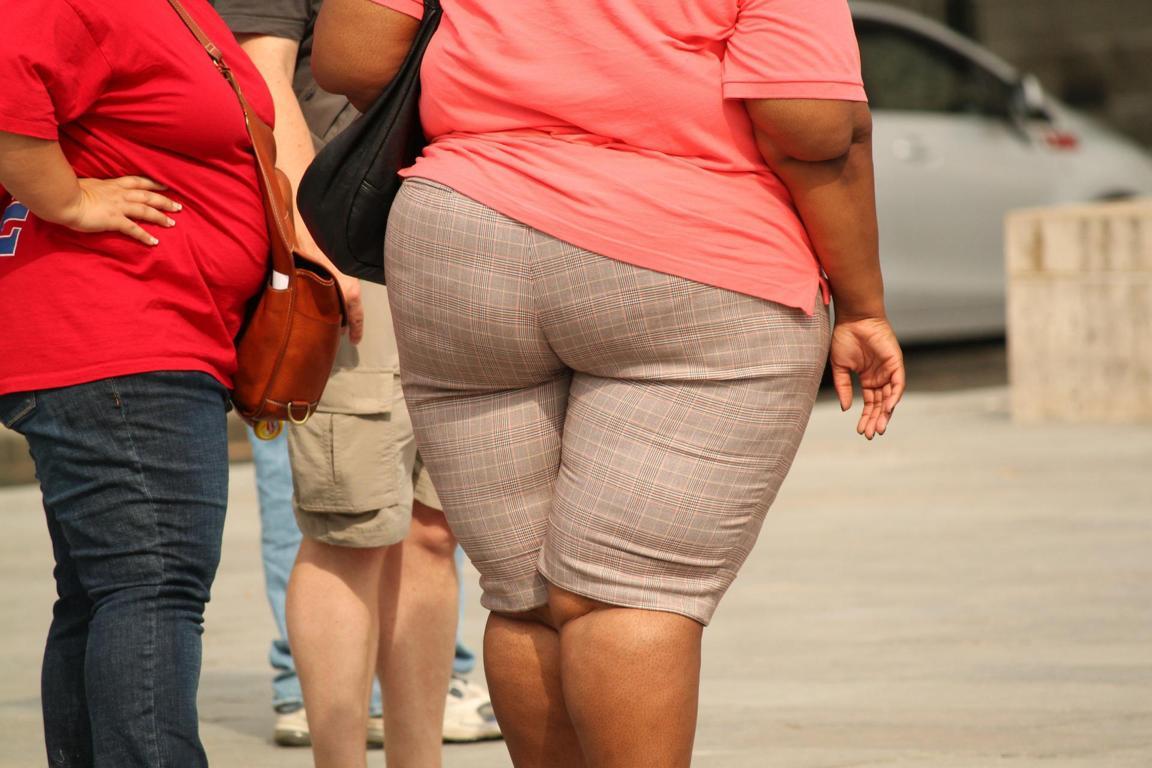 trattamento obesità