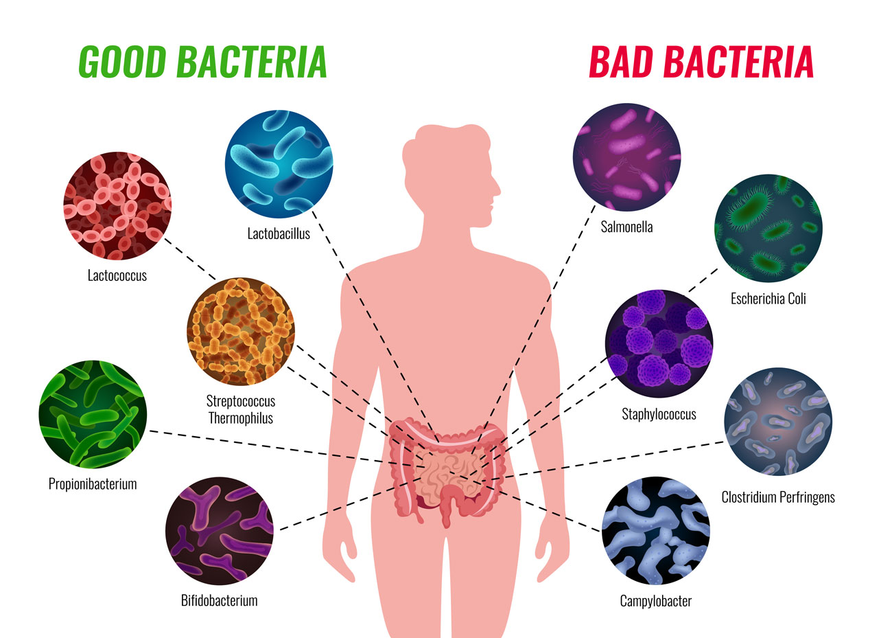 probiotici e fermenti lattici differenza